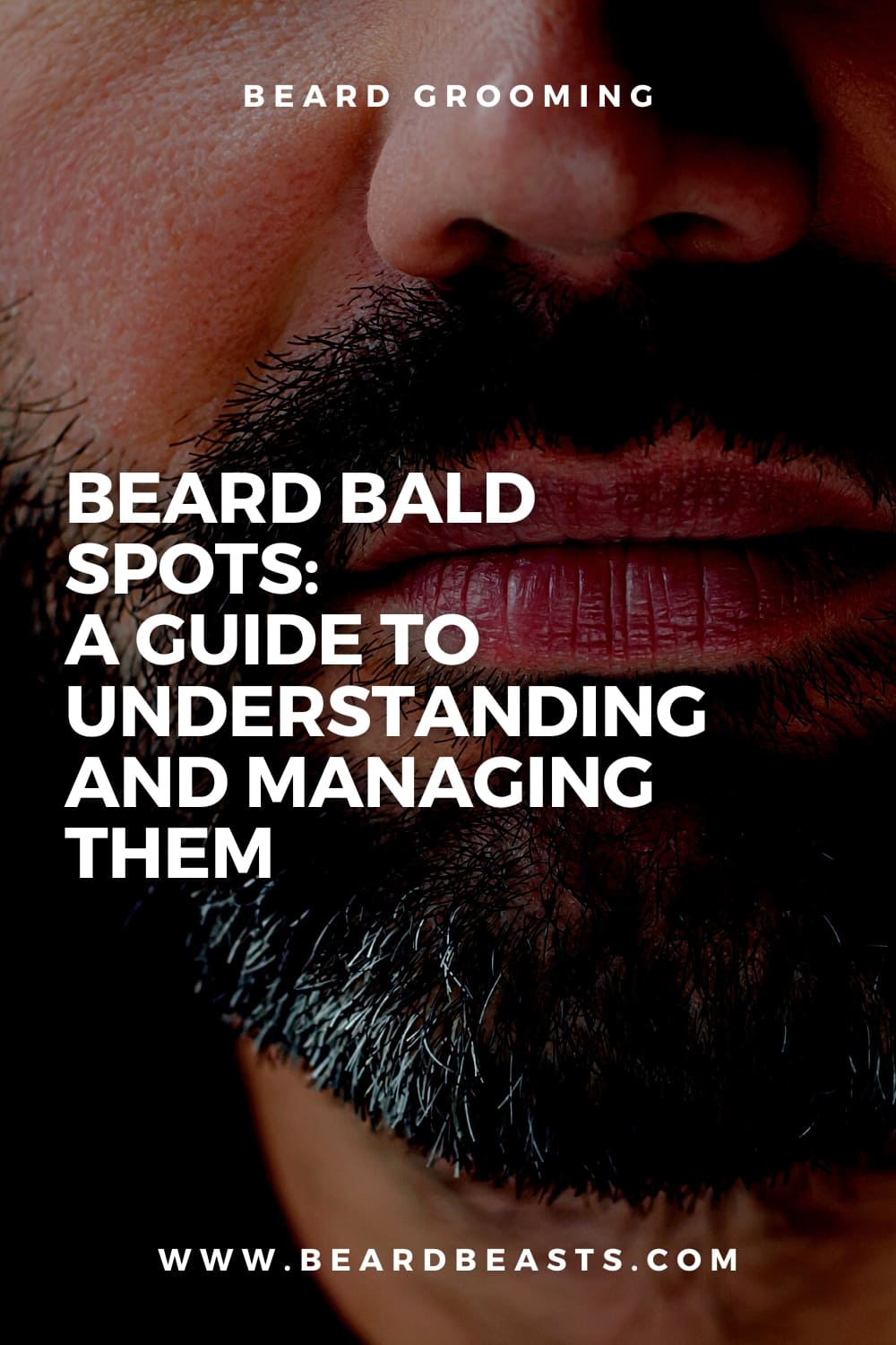 Beard Bald Spots:  A Guide to Understanding and Managing Them Pinterest Pin