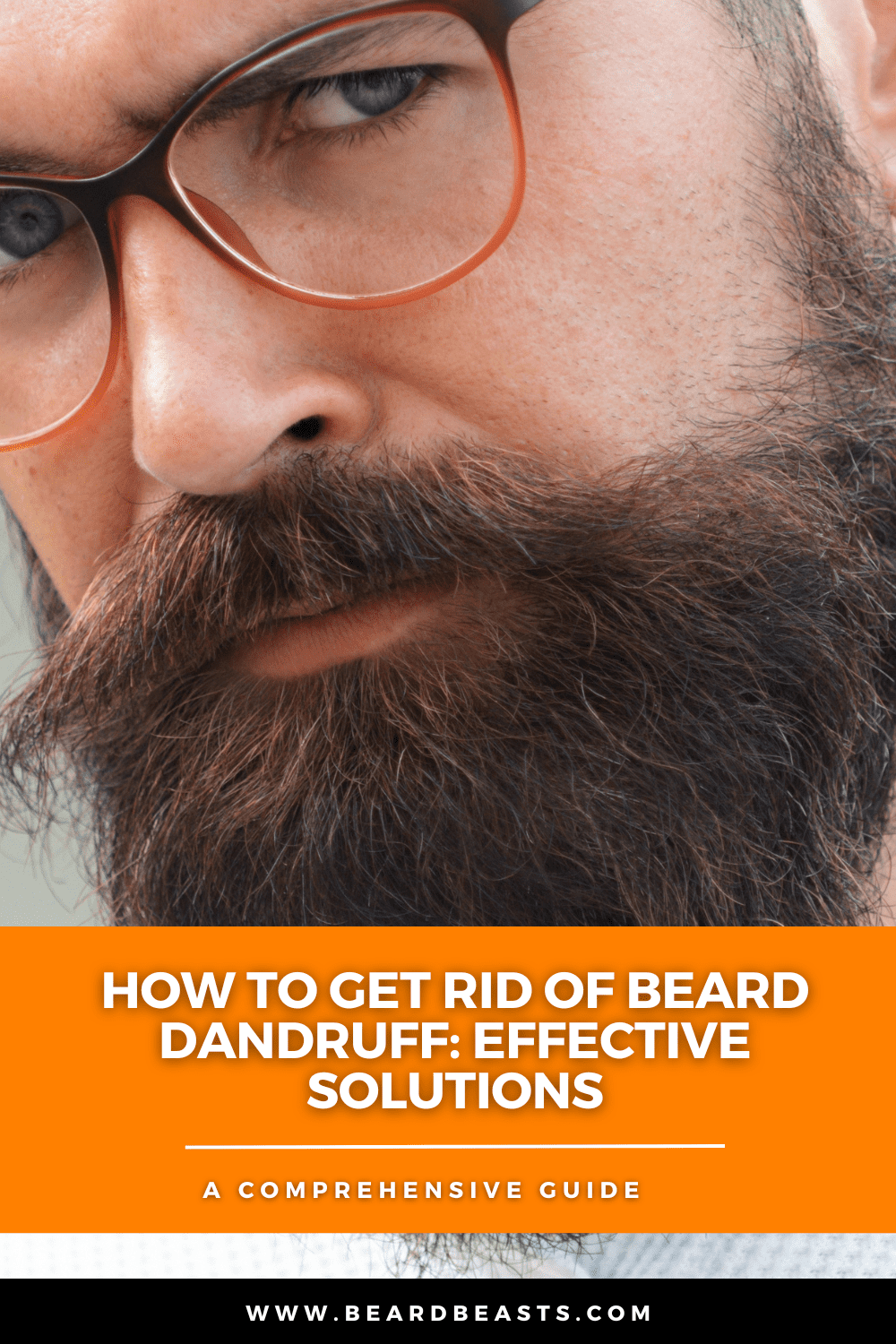 Close-up of a man with a well-groomed beard and glasses, featuring text overlay "How to Get Rid of Beard Dandruff: Effective Solutions" from www.beardbeasts.com. Learn comprehensive tips and solutions to maintain a healthy, dandruff-free beard.