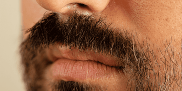 Close-up image of a man with a dry beard, showing the rough texture and brittleness typical of dry beard conditions.