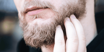 Close-up of a man's chin and beard with hand touching the facial hair. The man appears to have sores under his beard, indicating common beard issues such as poor hygiene, ingrown hairs, or infections.