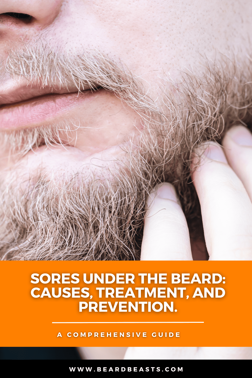 Close-up of a man touching his beard, highlighting irritation and possible sores under beard. The image promotes a comprehensive guide on the causes, treatment, and prevention of beard sores, available at www.beardbeasts.com.