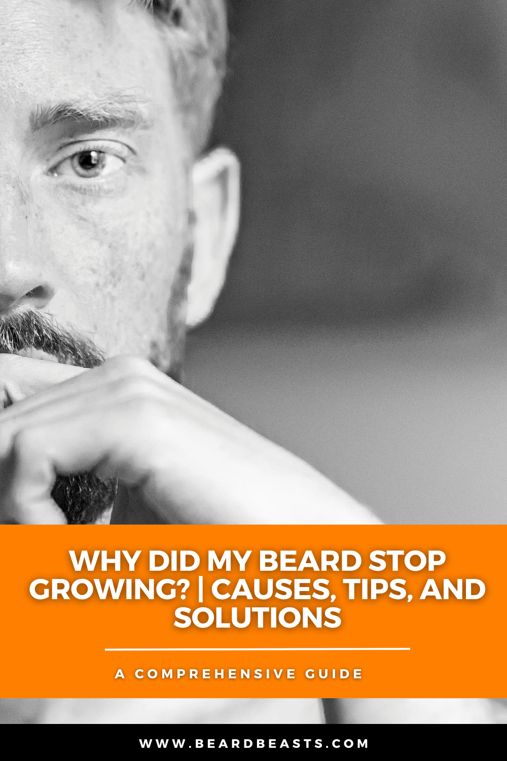 A black-and-white close-up image of a man with a well-groomed beard, resting his chin on his hand, looking thoughtful. The image includes an orange banner with the text, Why Did My Beard Stop Growing? | Causes, Tips, and Solutions" and "A Comprehensive Guide" below it. The banner also features a website URL, "www.beardbeasts.com." The contemplative expression on the man's face, combined with the informative text, suggests he is seeking answers about beard growth.